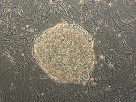 stem cell research at UW