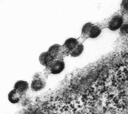 Immature HIV particles