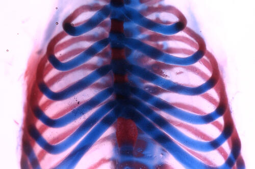 rib cage