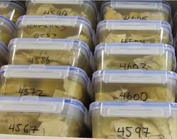 brain tissue samples