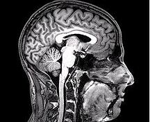 Georgetown researchers received NIH grant to study mechanisms that contribute to neurdegenerative disorders. 