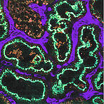 3234394452 f2b5d5d846 m