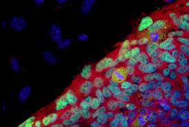 imagesCAJOFT5B resized 600