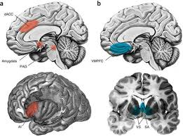 imagesCA4WB2SV resized 600