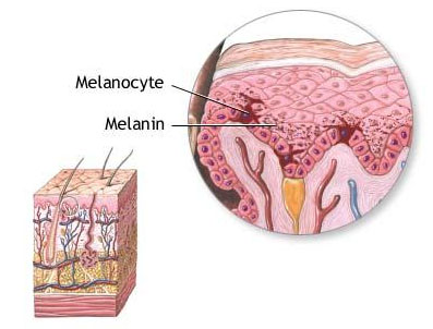 melanoma research