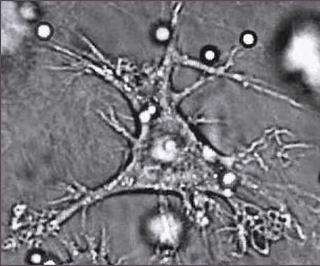Dendritic cell