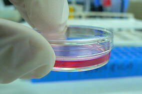 Researchers at Duke tested GsMTx4 from tarantula venom on cell cultures in petri dishes. 