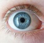 Cataracts are the most common form of vision impairment around the world. 