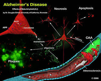 Biomedical_Researcher_Discovers_Alzheimer's_Disease_Breakthrough