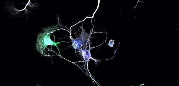 UA_neurons_axons_connections