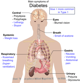 1024px-Main_symptoms_of_diabetes-092489-edited.png