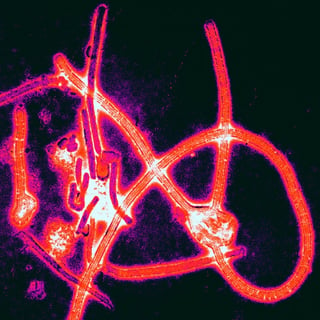 Ebola Virus. By Thomas W. Geisbert, Boston University School of Medicine [CC BY 2.5 (http://creativecommons.org/licenses/by/2.5)], via Wikimedia Commons