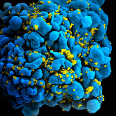 HIV Infected H9 T-Cell