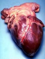 A human heart. Transferred from the English Wikipedia by Ewen, Public Domain, https://commons.wikimedia.org/w/index.php?curid=1750240