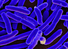 Image of E. coli via NIAID on Wikimedia Commons.