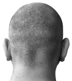 bald-head-1-1436556