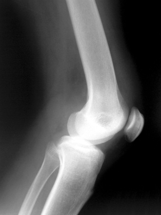 knee replacement, WSU, bioresearch, nanomaterials, biotechnology